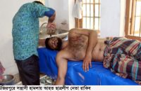 উজিরপুরে ছাত্রলীগ নেতাকে কুপিয়ে জখমের ঘটনায় মামলা