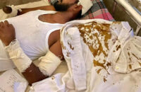 গৌরনদীতে যুবলীগ আরেক নেতাকে কুপিয়ে মারাত্মক জখম