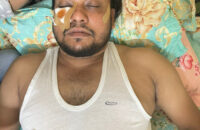 আদালত চত্বরে যুবলীগ নেতাকর্মীর হামলার শিকার গৌরনদীর দুই ছাত্রদল নেতা