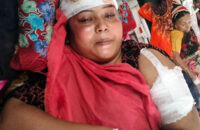 স্ত্রীকে কুপিয়ে হত্যা চেষ্টার অভিযোগ স্বামীর বিরুদ্ধে